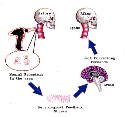 Arthrostim_neurological_effects.gif