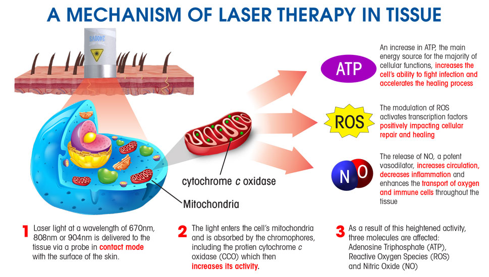 Laser Diagram